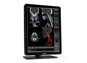 NIO 3MP LED (MDNG-3220)