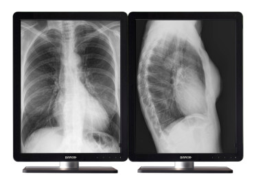 NIO 5MP LED (MDNG-5221)