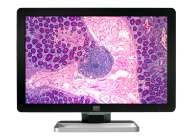 CORONIS FUSION 6MP LED (MDCC-6330)