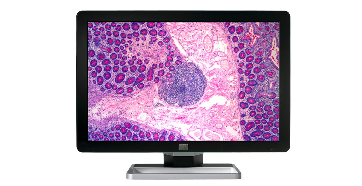 CORONIS FUSION 6MP LED (MDCC-6330)