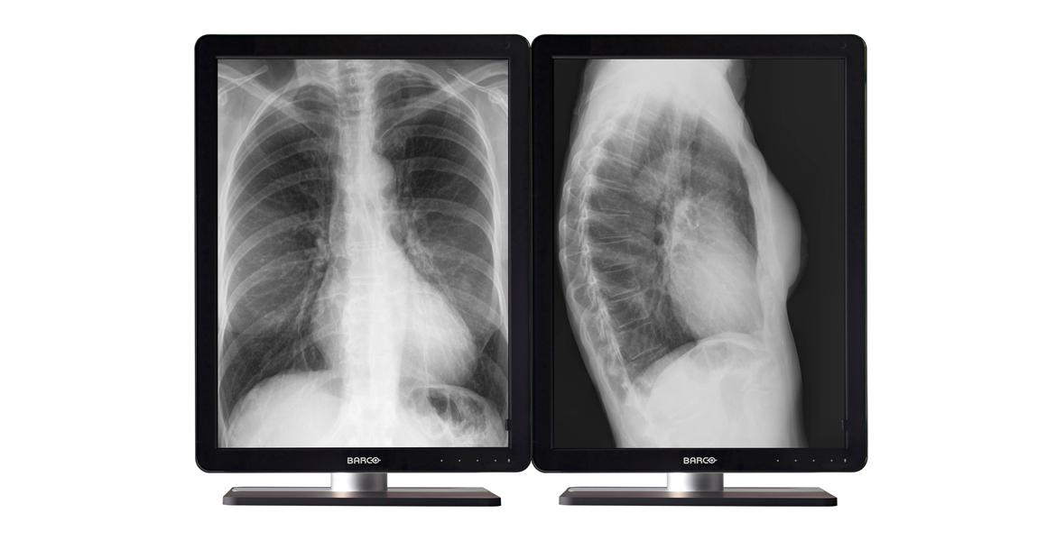 NIO 5MP LED (MDNG-5221)