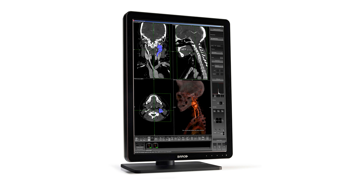 NIO 3MP LED (MDNG-3220)